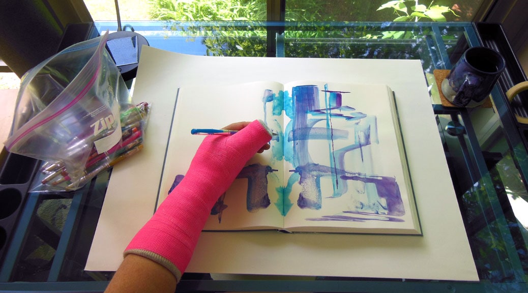 Arm in cast, working in journal.